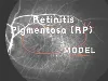 Retinitis Pigmentosa (RP) NHP-modell